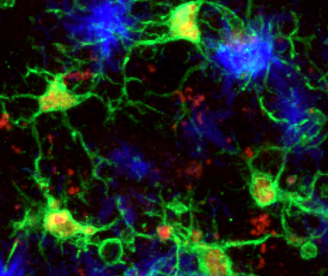 Microglia en el cerebro de rata